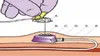 CE FDA Certificate Chinese Safety Huber Needles for Long-Term Infusion